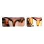 122037_1